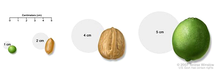  Pea, peanut, walnut, and lime show tumor sizes. 